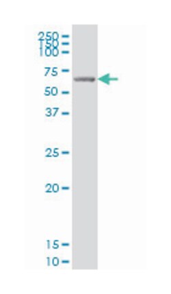 GRK6, Mouse, Clone: 8B7, Abnova 100 &mu;g | Buy Online | Abnova | Fisher Scientific