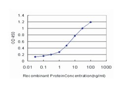 GRK6, Mouse, Clone: 8B7, Abnova 100 &mu;g | Buy Online | Abnova | Fisher Scientific