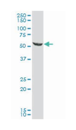 MAP kinase interacting serine/threonine kinase 2, Mouse, Polyclonal Antibody,