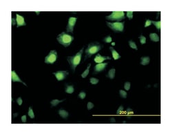 MAP kinase interacting serine/threonine kinase 2, Mouse, Clone: 4F11, Abnova