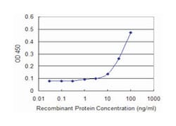 glutamic-pyruvate transaminase (alanine aminotransferase), Mouse, Clone:
