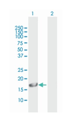 glutamate receptor, ionotropic, N-methyl D-aspartate 2C, Mouse, Polyclonal