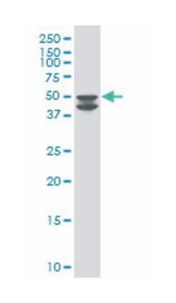 glycogen synthase kinase 3 beta, Mouse, Polyclonal Antibody, Abnova 50 &mu;L | Buy Online | Abnova Corporation | Fisher Scientific