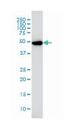 GSR, Mouse, Clone: 6B4, Abnova 100&mu;g; Unlabeled:Antibodies, Monoclonal