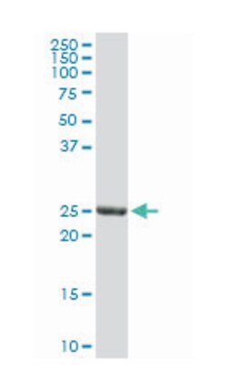 glutathione S-transferase alpha 3, Rabbit, Purified MaxPab Polyclonal Antibody, Abnova 100 &mu;g | Buy Online | Abnova | Fisher Scientific