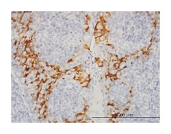 glutathione S-transferase alpha 3, Mouse, Clone: 1F11, Abnova&trade;