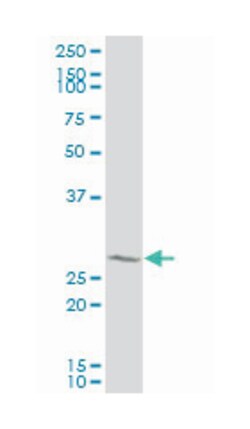 general transcription factor IIH, polypeptide 3, 34kDa, Mouse, Polyclonal Antibody, Abnova 50 &mu;L | Buy Online | Abnova | Fisher Scientific