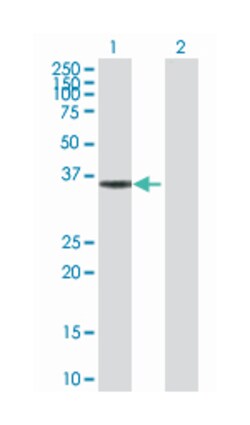 3-hydroxymethyl-3-methylglutaryl-Coenzyme A lyase, Rabbit, Purified MaxPab