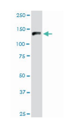 GTF2I, Mouse, Polyclonal Antibody, Abnova 50 &mu;L | Buy Online | Abnova | Fisher Scientific