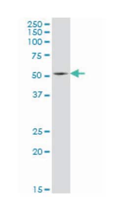heat shock transcription factor 4, Mouse, Clone: 3G3, Abnova 100 &mu;g | Buy Online | Abnova Corporation | Fisher Scientific