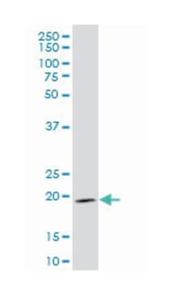 Indian hedgehog homolog (Drosophila), Mouse, Clone: 2G9, Abnova 100&mu;g;