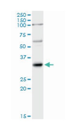 IL1B, Rabbit, MaxPab Polyclonal Antibody, Abnova 100&mu;L; Unlabeled:Antibodies,