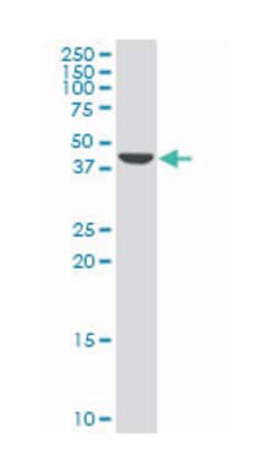 potassium inwardly-rectifying channel, subfamily J, member 2, Mouse, Polyclonal Antibody, Abnova 50 &mu;L | Buy Online | Abnova Corporation | Fisher Scientific