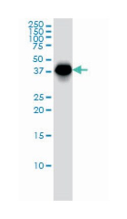 MAGEA9, Mouse, Clone: 1C2, Abnova 200 &mu;L | Buy Online | Abnova | Fisher Scientific