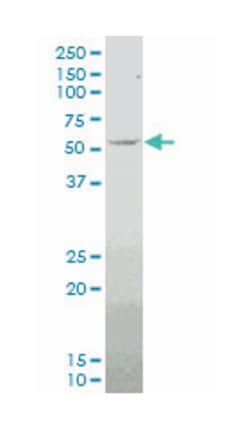 myocyte enhancer factor 2D, Mouse, Clone: 4D6, Abnova 100&mu;g; Unlabeled:Antibodies,