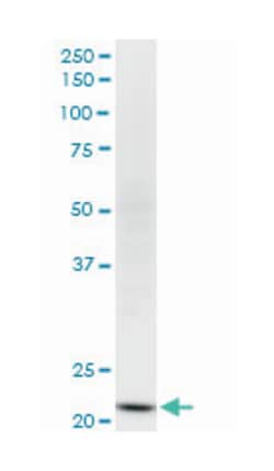 NDUFV2, Mouse, Clone: 1A10, Abnova 100&mu;g; Unlabeled:Antibodies, Monoclonal