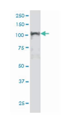 nuclear factor of kappa light polypeptide gene enhancer in B-cells 1, Mouse, Clone: 3F6, Abnova™