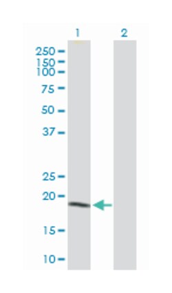 nonmetastatic cells 1, protein (NM23A) expressed in, Rabbit, Purified MaxPab Polyclonal Antibody, Abnova 100 &mu;g | Buy Online | Abnova | Fisher Scientific