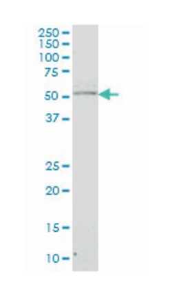 NR4A2, Mouse, Clone: 3E10, Abnova 100&mu;g; Unlabeled:Antibodies, Monoclonal