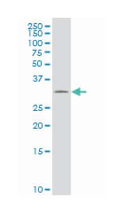solute carrier family 22 (organic cation transporter), member 18 antisense,