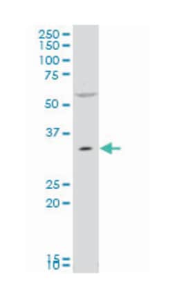 peroxisomal biogenesis factor 7, Mouse, Polyclonal Antibody, Abnova 50&mu;L;