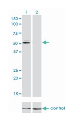 GSR, Mouse, Clone: 6B4, Abnova 100&mu;g; Unlabeled:Antibodies, Monoclonal