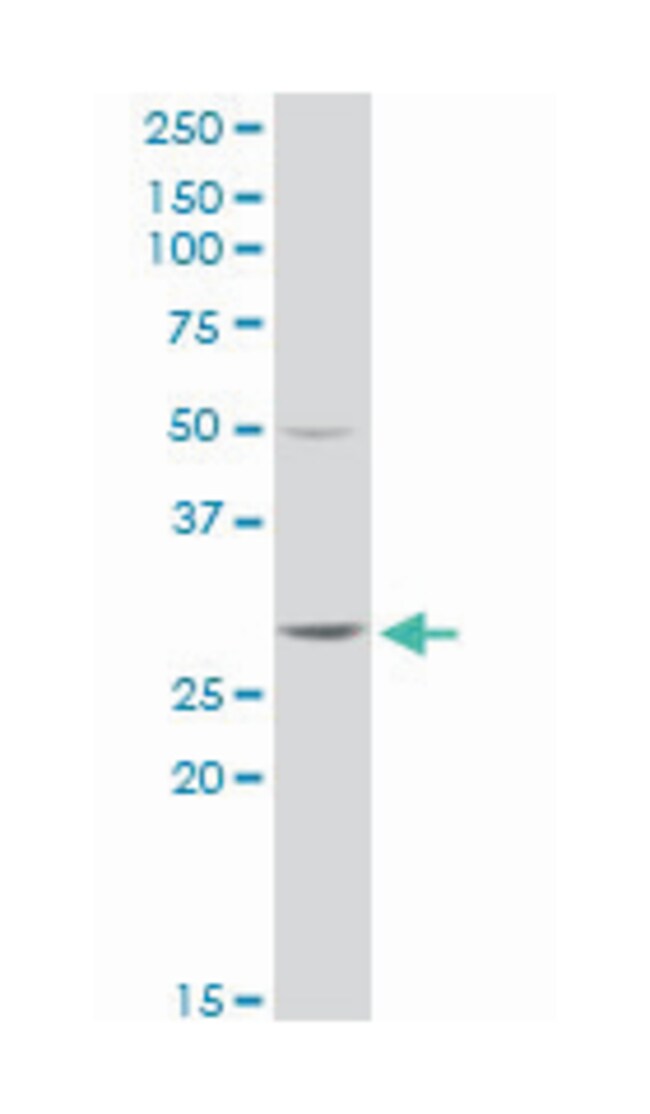 glutathione s transferase theta 2 antibody glutathione S-transferase theta 2, Rabbit, Purified MaxPab™ Polyclonal  Antibody, Abnova™