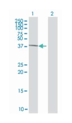 general transcription factor IIH, polypeptide 2, 44kDa, Mouse, Polyclonal