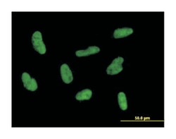 general transcription factor IIH, polypeptide 2, 44kDa, Mouse, Polyclonal
