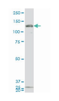 guanylate cyclase 2C (heat stable enterotoxin receptor), Mouse, Clone: