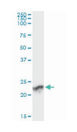 GUK1, Mouse, Clone: 4C3-1A7, Abnova 100&mu;g; Unlabeled:Antibodies, Monoclonal
