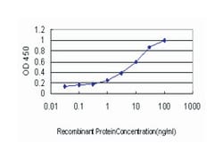 guanylate cyclase 2D, membrane (retina-specific), Mouse, Clone: 6D9, Abnova