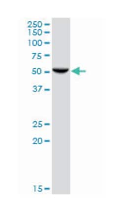 HARS (B01), Mouse anti-Human, Polyclonal Antibody, Abnova 50 &mu;L | Buy Online | Abnova Corporation | Fisher Scientific