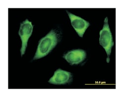 HARS (B01), Mouse anti-Human, Polyclonal Antibody, Abnova 50 &mu;L | Buy Online | Abnova Corporation | Fisher Scientific