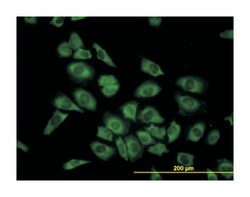 histidyl-tRNA synthetase, Mouse, Clone: 1C8, Abnova 100&mu;g; Unlabeled:Antibodies,