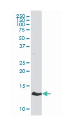 HBZ, Mouse, Clone: 3C4-1D5, Abnova 100&mu;g; Unlabeled:Antibodies, Monoclonal