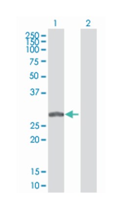 proteasome (prosome, macropain) 26S subunit, non-ATPase, 8 (B01), Mouse