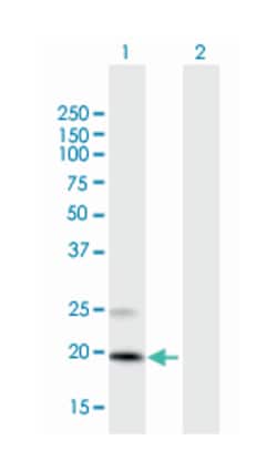 prostaglandin D2 synthase 21kDa (brain), Mouse, Polyclonal Antibody, Abnova