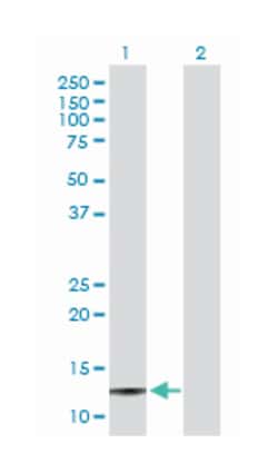 serum amyloid A4, constitutive, Rabbit, Purified MaxPab Polyclonal Antibody, Abnova 100 &mu;g | Buy Online | Abnova Corporation | Fisher Scientific