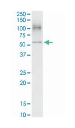 solute carrier family 3 (activators of dibasic and neutral amino acid transport),