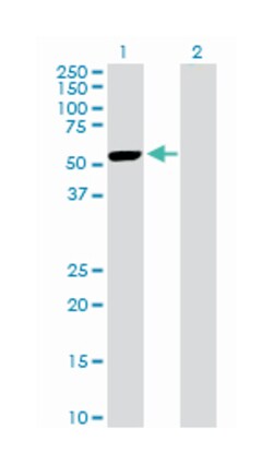 mitogen-activated protein kinase-activated protein kinase 5, Rabbit, Purified