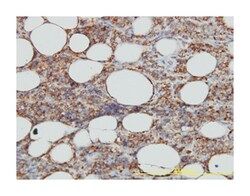 HLA-DMA, Mouse, Clone: 3F12-F11, Abnova 100&mu;g; Unlabeled:Antibodies,