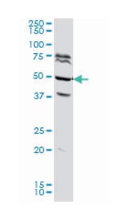 FOXA2, Mouse, Clone: 7G10, Abnova 200&mu;L; Unlabeled:Antibodies, Monoclonal