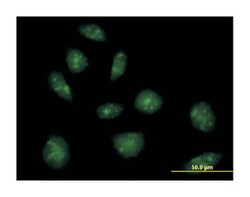 interleukin 16 (lymphocyte chemoattractant factor), Rabbit, Purified MaxPab