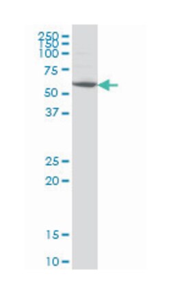 interleukin-1 receptor-associated kinase 2, Mouse, Clone: 3H1, Abnova&trade;