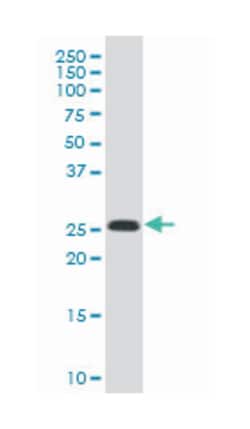 killer cell lectin-like receptor subfamily C, member 1, Mouse, Polyclonal