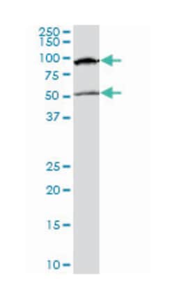 methyl CpG binding protein 2 (Rett syndrome), Mouse, Clone: 4B6, Abnova