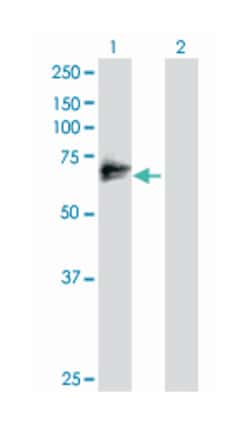 matrix metallopeptidase 2 (gelatinase A, 72kDa gelatinase, 72kDa type IV