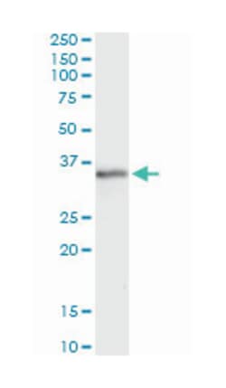MSX1, Mouse, Clone: 1E2, Abnova&trade;