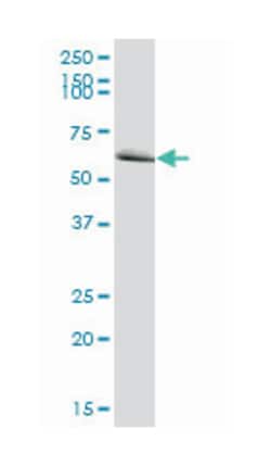 MTM1, Mouse, Polyclonal Antibody, Abnova 50&mu;g; Unlabeled:Antibodies,